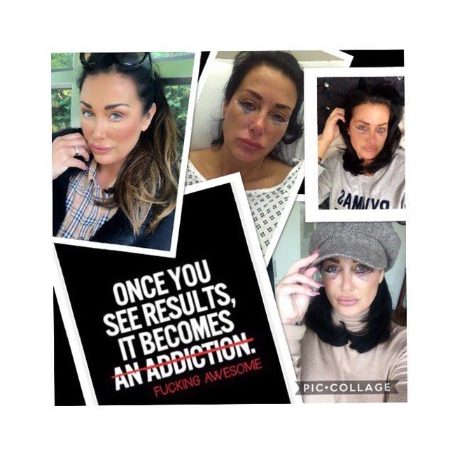 Wanita 46 tahun itu pun menganggap dirinya kuat seperti Wonder Woman. Aku cukup kebal dan gigih, aku bisa menghadapi rasa sakit. Aku seperti Wonder Woman, jujur aku seharusnya jadi karakter Marvel, tuturnya. Foto: Instagram @aimis_world