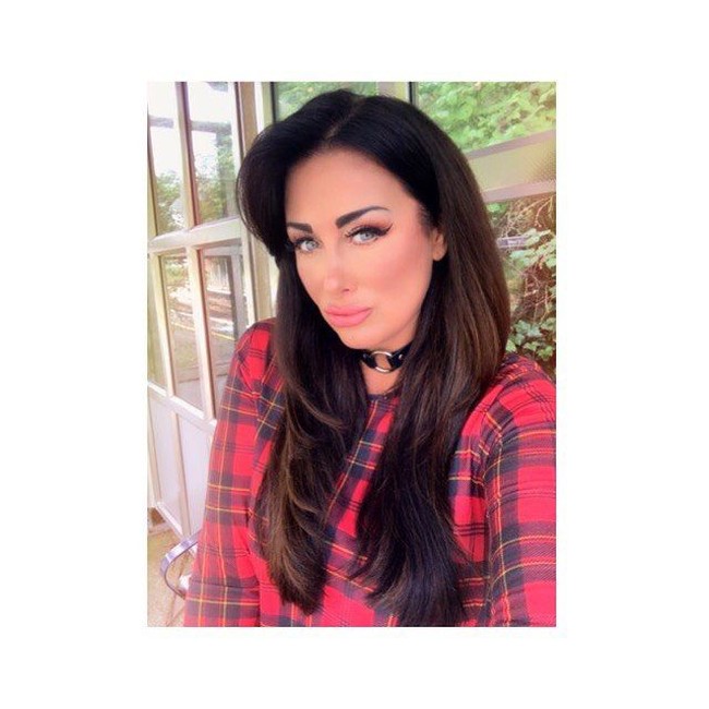 Selain operasi bokong, Aimi berencana untuk melakukan veneer gigi, operasi payudara lagi, operasi bokong untuk ketiga kali, face lift, dan operasi vagina. Sejauh ini, Aimi sudah mengeluarkan uang sebesar £100 ribu atau Rp 1,8 miliaran untuk operasi. Foto: Instagram @aimis_world