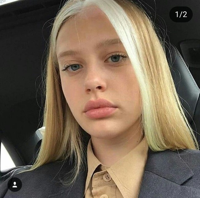 Vitiligo menjadi bagian dari hidupku dan hal itu sama sekali bukan masalah. Suatu hari, teman saya bertanya, apakah vitiligo saya menular. Saya tidak tersinggung, saya hanya berpikir itu pertanyaan aneh, ungkap Tia seperti dikutip dari I-d Vice. Foto: Dok. Instagram (@tiajonsson)