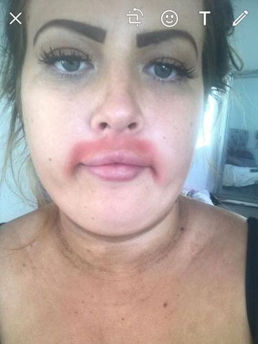 Cukur Kumis dengan Krim Penghilang Rambut, Wanita Ini Alami Hal Memalukan