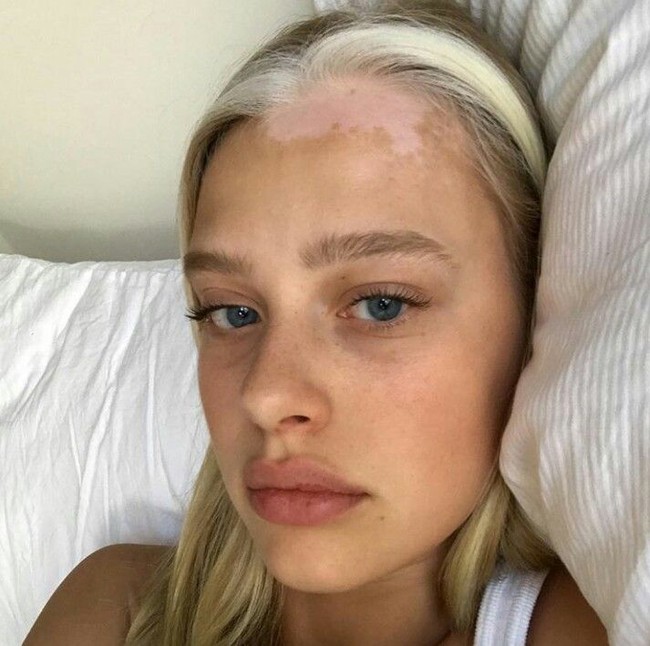 Rambutnya terlihat keren. Pertama kali melihatnya, pasti orang berpikir bahwa rambut bagian depannya hasil dari meng-highlight rambut. Foto: Dok. Instagram (@tiajonsson)