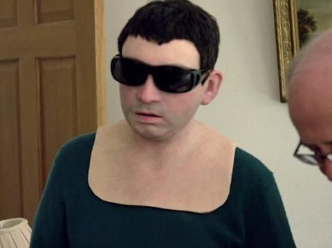 Alergi Matahari, Pria Ini Pakai Topeng Replika Wajahnya Sendiri