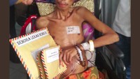 Fisik Valentinus tampak lemah dan tubuhnya sangat kurus. Foto: Twitter/KEMENPORA_RI