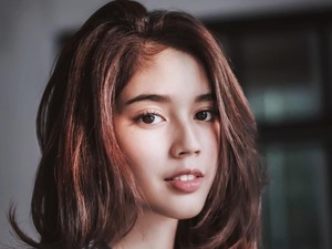 Bikin Pangling, Fay Nabila Dituding Suntik Putih