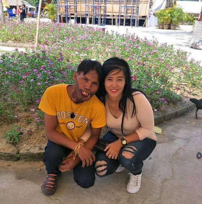 Bumin adalah seorang wanita cantik yang berasal dari Provinsi Songkhla, Thailand. Ia pun menikah dengan seorang pria yang kondisi fisik tak sempurna. Suami Bumin menderita penyakit langka yang menyebabkan bibirnya membesar dan tak bisa menutup. Foto: Facebook