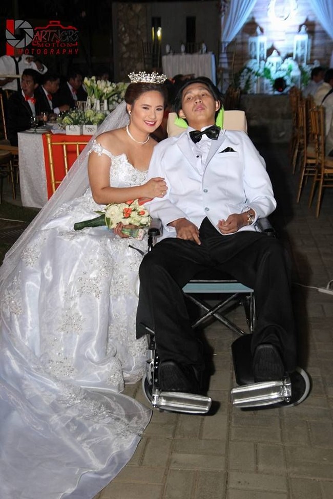 Wanita cantik bernama Angela Dion Mallari dari Filipina melabuhkan cintanya pada seorang pria dan tak memandang keadaan fisik. Bagi Angela dan Christian, cinta mereka membuktikan bahwa ada hal-hal dalam hidup yang pasti dapat bertahan selamanya. Foto: Facebook