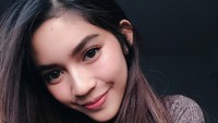 Bahkan ada yang menuding Fay Nabila melakukan suntik untuk membuat kulitnya putih. Foto: Dok. Instagram/faynabilalxndr