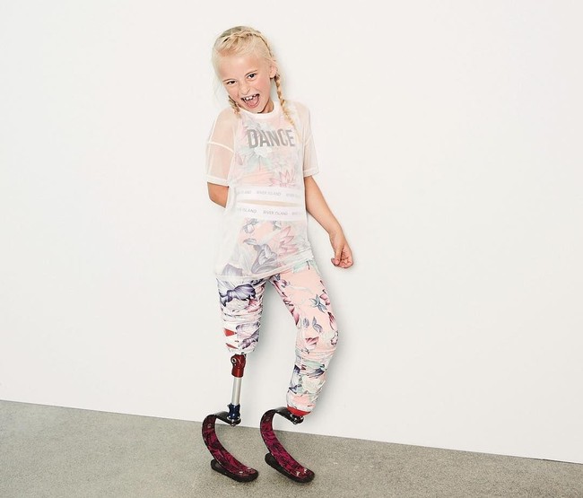 Ketika masih berusia 18 bulan, kedua kakinya harus diamputasi karena mengidap fibular hemimelia sejak lahir. Foto: Dok. Instagram/Daisy-May Demetre