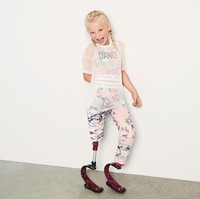 Ketika masih berusia 18 bulan, kedua kakinya harus diamputasi karena mengidap fibular hemimelia sejak lahir. Foto: Dok. Instagram/Daisy-May Demetre