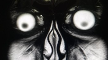 Hiiiii, ini adalah hasil MRI pada wajah. (Foto: Brightside)