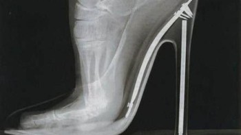 Beginilah tulang kaki wanita ketika menggunakan sepatu hak tinggi. (Foto: Brightside)