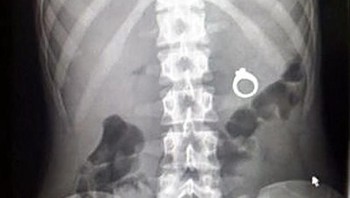 Cincinnya kok malah ditelan ya? (Foto: Brightside)