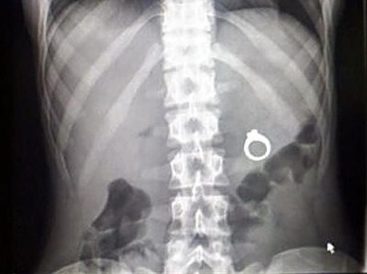 Kumpul Potret Aneh Hasil SInar X Bikin Geleng-geleng