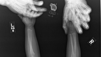 Putriku menolak untuk melakukan X-ray tanpa Peppa Pig (boneka). Foto: Brightside