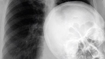 Ada yang ngintip-ngintip nih. (Foto: Brightside)