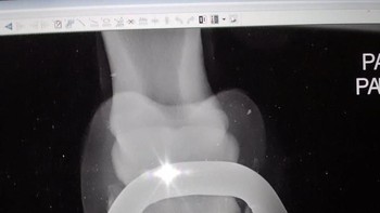 Penasaran bagimana hasil sinar X kaki kuda? begini hasilnya. (Foto: Brightside)