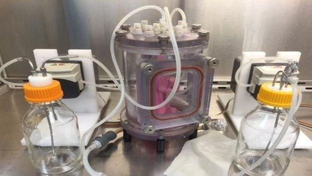 Paru-paru organik buatan berhasil ditransplantasi ke babi.