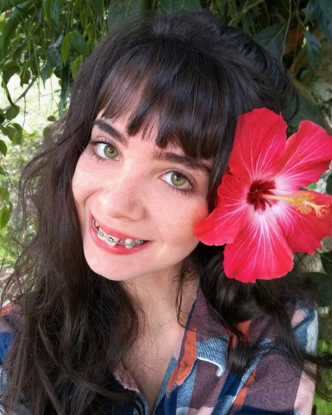 Sosok Driely populer di media sosial bukan hanya karena wajah cantiknya yang unik. Dia juga terkenal sebagai selebgram yang memiliki gigi berantakan dan tetap percaya diri dengan penampilannya tersebut meski kerap dicaci netizen. Foto: Instagram