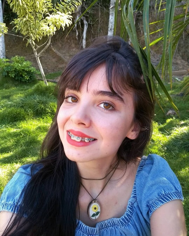 Dalam salah satu keterangan fotonya yang menampilkan senyumnya dengan gigi berkawat yang tampak belum rapi, Driely mengungkapkan gigi berantakannya terjadi karena di masa lalu dia tidak suka ke dokter gigi. Namun sekarang dia sudah sadar dan tidak lagi malas merawat giginya. Foto: Instagram