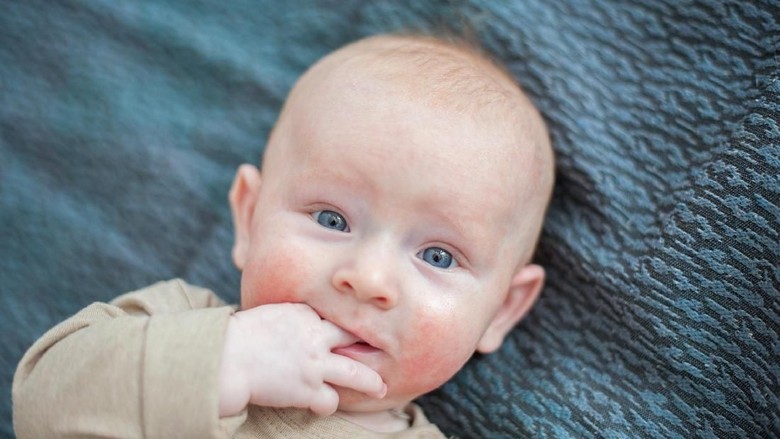 Kenali Dermatitis Atopik yang Bikin Kulit Bayi Gatal/ Foto: Thinkstock Kenali Dermatitis Atopik yang Bikin Kulit Bayi Gatal/ Foto: Thinkstock