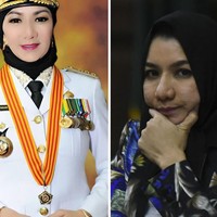 Kulit wajah Rita kini terlihat kasar dengan bopeng di sana-sini. Wajah mulusnya dulu sudah benar-benar menghilang.  Foto: ANTARA/Hafidz Mubarak A, Instagram/ritawidyasari73