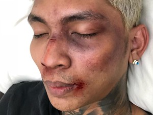 Warganet Anggap Aksi Prank Young Lex yang Ngaku Dipukuli Fitnah