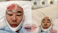 Banyak yang menyebut hal itu disebabkan oleh keputusan Roy yang absen syuting demi operasi plastik. Dok. Instagram/lambe_turah