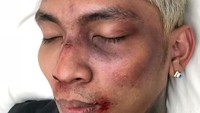 Rapper tersebut mengaku bertengkar dengan fans kpop dan keamanan di sebuah acara. Dok. Instagram/young_lex18