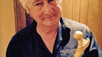 Usai menjalani operasi penggantian pinggul baru, pria ini menggunakan tulang pinggul lamanya sebagai tongkt jalan. (Foto: Brightside)