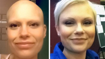 Foto dulu dan sekarang, setelah 5 tahun berjalan wanita ini berhasil mengalahkan penyakit kankernya. (Foto: Brightside)