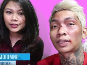 Di Balik Wajah Babak Belur Young Lex yang Ternyata Tipuan