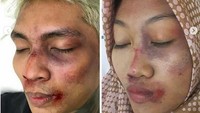 5. Dari aksi para warganet, ternyata banyak mengundang komentar menggelitik dari fans maupun hatters. Foto: Instagram Young Lex
