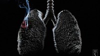 Dibuat oleh NeogamaBBH, menggambarkan betapa kejamnya rokok bagi paru-paru. 