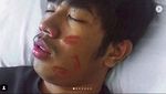 Kocak! Aksi Fans Meniru Wajah Babak Belur Young Lex