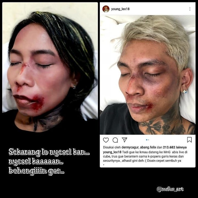 Dibully Netizen, Young Lex Senang Ada Banyak Meme Wajah Babak Belurnya Foto: @nufus_art/ Instagram Dibully Netizen, Young Lex Senang Ada Banyak Meme Wajah Babak Belurnya Foto: @nufus_art/ Instagram