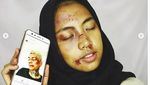 Kocak! Aksi Fans Meniru Wajah Babak Belur Young Lex