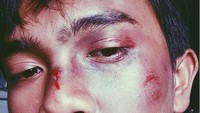 6. Kira-kira warganet ini belajar makeup dari mana ya? Foto: Instagram Young Lex