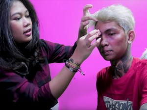 Wajah Babak Belur Young Lex Hoax, Dina Lorenza Resmi Cerai