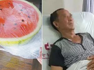 Waduh! Karena Makan Semangka dari Kulkas, Pria Ini Kena Obstruksi Usus