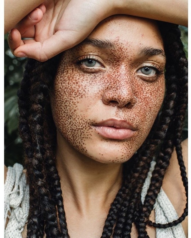 Kokie adalah model cantik yang memiliki banyak bintik freckle di wajah. Bukan hanya di bagian pipi atau hidung, freckle Kokie memenuhi 70% wajahnya. Meski banyak menerima tawaran kerja sebagai model, ia mengaku tetap fokus pada studinya di bidang biologi. Foto: Instagram