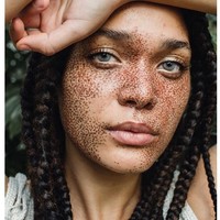Kokie adalah model cantik yang memiliki banyak bintik freckle di wajah. Bukan hanya di bagian pipi atau hidung, freckle Kokie memenuhi 70% wajahnya. Meski banyak menerima tawaran kerja sebagai model, ia mengaku tetap fokus pada studinya di bidang biologi. Foto: Instagram