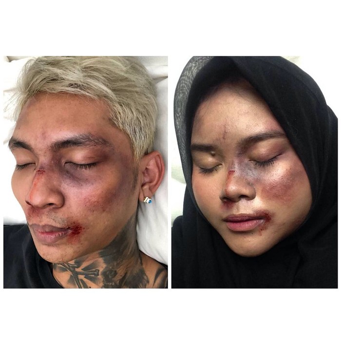 Viral Tutorial Makeup Muka Babak Belur Young Lex Seperti Ini Hasilnya