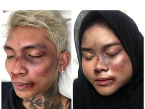 Viral Tutorial Makeup Muka Babak Belur Young Lex, Seperti Ini Hasilnya