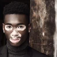 Tak banyak model pria yang tampil dengan kelainan kulit vitiligo. Dengan kondisi tersebut, Yvesmark Chery pun lebih mudah dikenali dan menarik atensi di industri fashion. Foto: Instagram