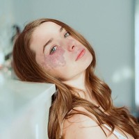 Punya tanda lahir besar di wajah, Sarah Taylor sempat di-bully ketika kecil. Namun saat dewasa, tampilan unik itu justru membuatnya terkenal. Sarah pun tidak menutupi tanda lahir itu karena memang jarang pakai makeup. Foto: Instagram