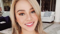 Dibalik senyum dan kebahagian Aurel Hermansyah ternyata ia menyimpan sebuah luka. Dok. Instagram/aurelie.hermansyah