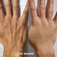 Tren Perawatan Prewedding untuk Wanita yang Malu Tangannya Seperti Pria