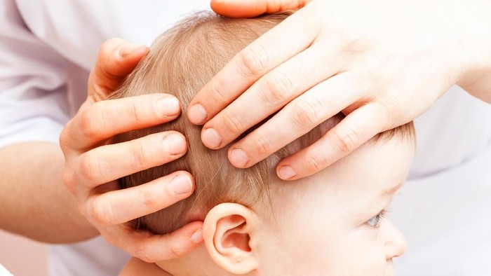 Apakah Benjolan di Belakang Kepala Bayi Bahaya? Ini Penyebabnya