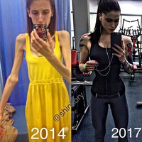 Wanita berusia 19 tahun ini pernah menjadi sangat kurus tanpa disadari oleh keluarganya. Kesehatan Vera juga memburuk karena terlalu kurus. Foto: Instagram