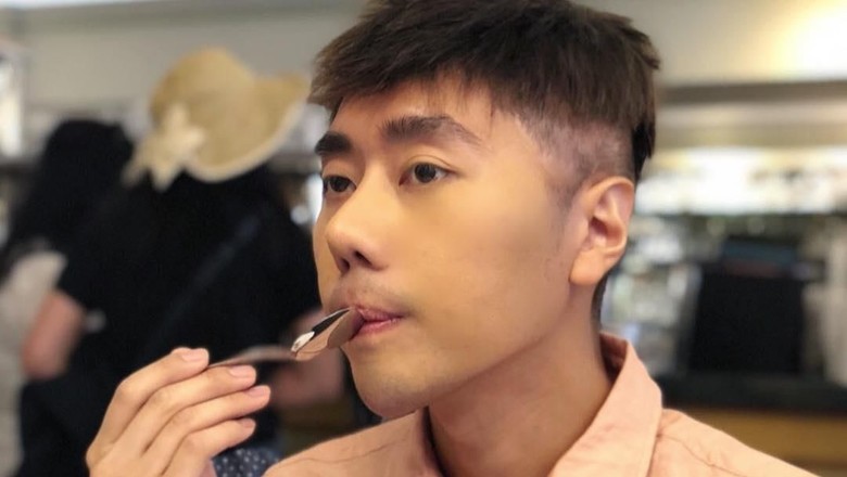 Roy Kiyoshi Bergigi Kelinci usai Oplas, Netizen Gaduh Roy Kiyoshi Bergigi Kelinci usai Oplas, Netizen Gaduh